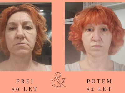 Predstavitev Joge obraza