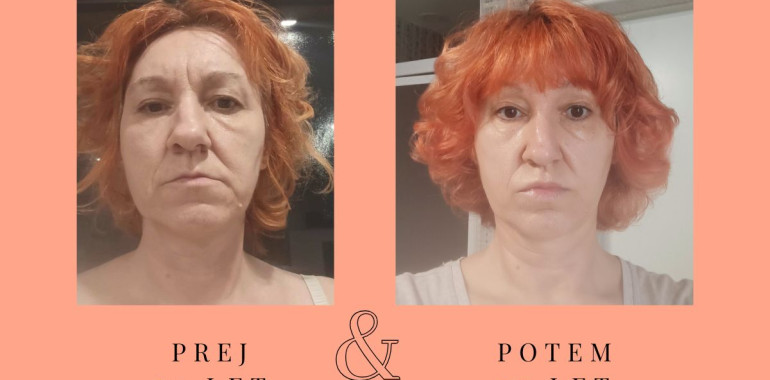 Predstavitev Joge obraza