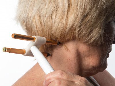 Akupunktura z domačega kavča – CWP, čudežni krotilec bolečin in bolezni?