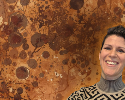 Odstrani miome, ciste, bradavice in tvorbe - DM in MD