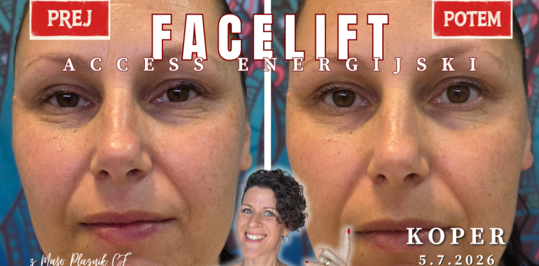 Access Energijski facelift™ delavnica