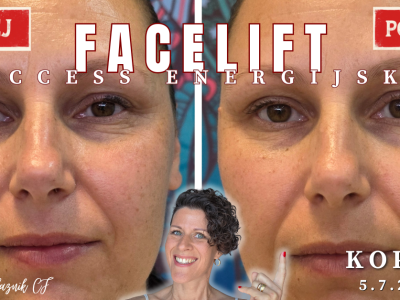 Access Energijski facelift™ delavnica