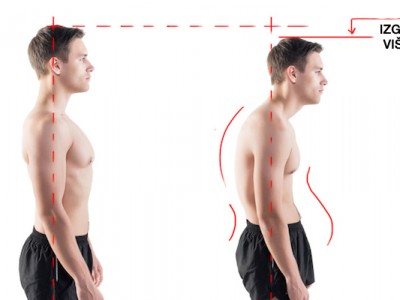 Tudi moški imajo hrbtenico kajne?