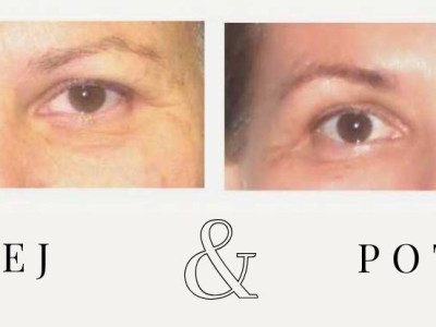 Nadaljevalni tečaj Joge obraza  