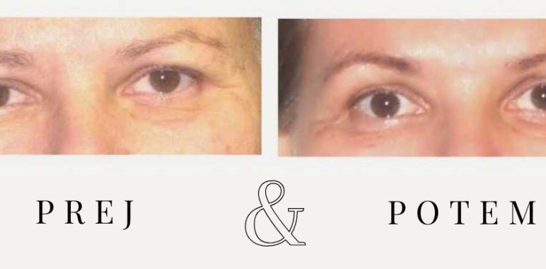 Nadaljevalni tečaj Joge obraza