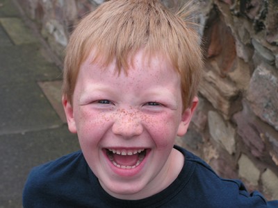 Joga smeha blagodejno vpliva na sladkorno bolezen