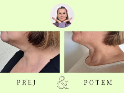 Osnovni tečaj Joge obraza *** Možnost preizkušnje