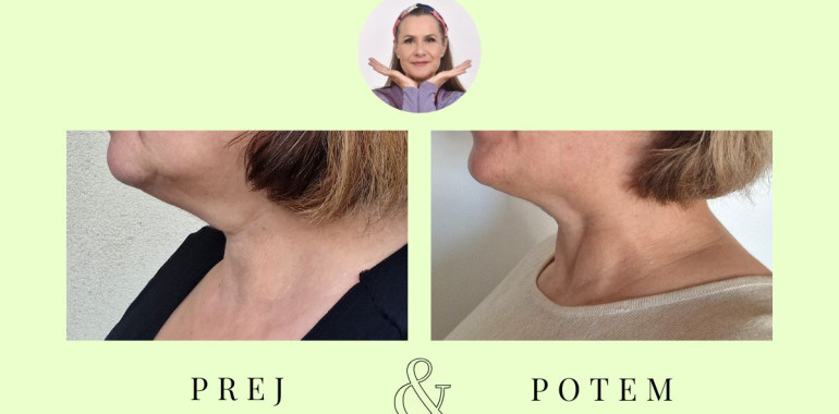 Osnovni tečaj Joge obraza *** Možnost preizkušnje